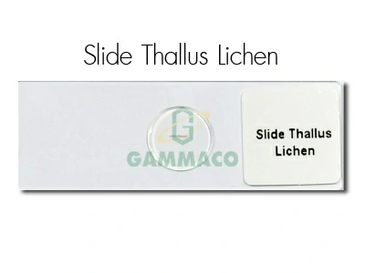 ทาลลัส ไลเคนส์