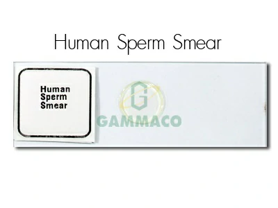 Human Sperm. Smear.