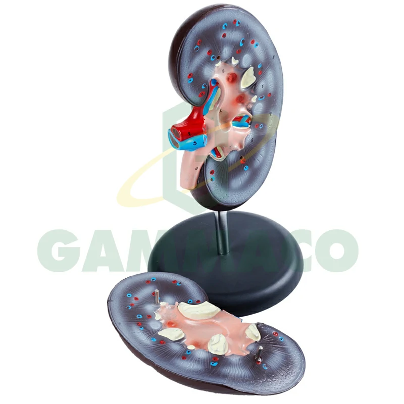 Human giant kidney model