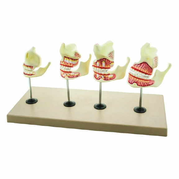 Tooth development model